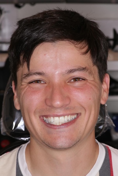 Adam After
