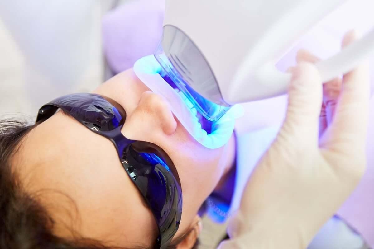 Blue Light Teeth Whitening: Is It Safe, and Does It Work?