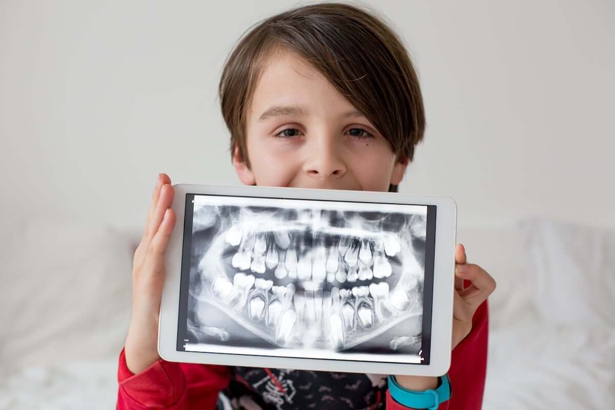 Are Dental X-Rays Safe for Children? Separating Fact from Fiction