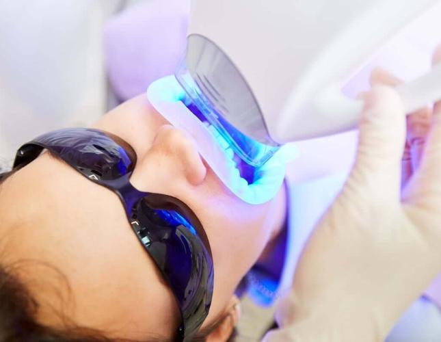 Blue Light Teeth Whitening: Is It Safe, and Does It Work?