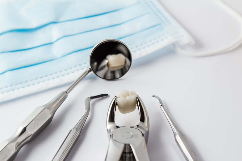 Tooth Extraction and Aftercare - Your Most Common Questions Answered